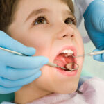 dental crowns for your child