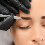 brow lift by Dr. Cox